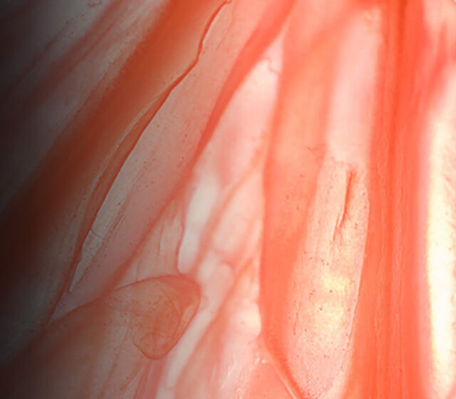 Endophytol Image