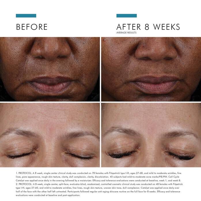 سيل سايكل كاتاليست